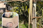 Vecino fue internado tras la mordedura de una yarará en Las Chacras: escasez de suero antiofídico generó operativo sanitario