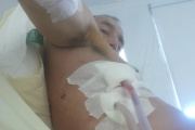 Plomero apuñalado al resistir un robo pide ayuda para sobrellevar su recuperación