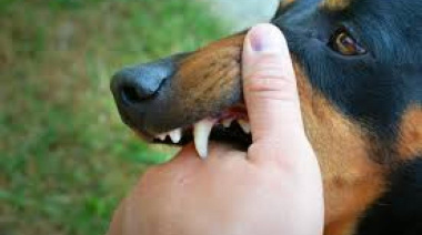 Ataque canino en General Madariaga: una mujer perdió el pulgar tras intentar salvar a su mascota