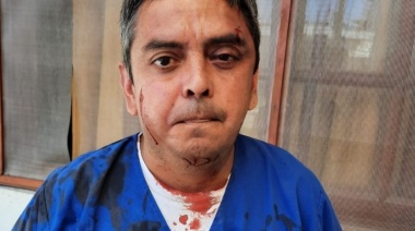 Feroz golpiza al Secretario de Salud Cachagua, a quien el agresor responsabiliza de haber contraído Covid-19