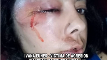 Novedades en la causa de Ivana, la joven golpeada brutalmente en San Clemente del Tuyú