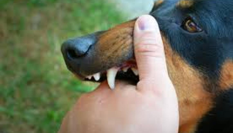 Ataque canino en General Madariaga: una mujer perdió el pulgar tras intentar salvar a su mascota