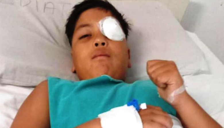 Apedrearon un micro con chicos de fútbol y un nene de 11 años sufrió graves heridas en un ojo
