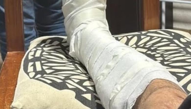 Mar de Ajó: denunció que fue golpeado tras ser confundido con un sospechoso del robo de motos