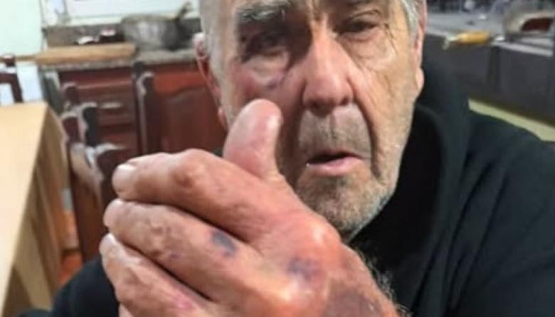 Brutal asalto a una pareja de 82 años: los golpearon e intentaron cortarle un dedo para robarle un anillo