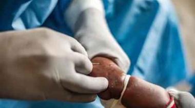 Alerta en China por la viruela del mono: implementan estrictos protocolos ante el crecimiento de casos