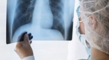 La Costa: Detectan tres casos de tuberculosis activa en estudiantes de escuelas del distrito