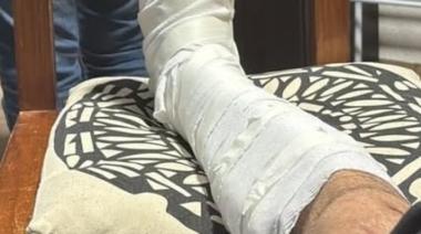 Mar de Ajó: denunció que fue golpeado tras ser confundido con un sospechoso del robo de motos