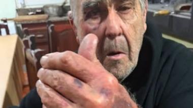 Brutal asalto a una pareja de 82 años: los golpearon e intentaron cortarle un dedo para robarle un anillo