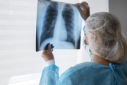 Preocupante aumento de casos de tuberculosis: creció un 65,9% entre 2020 y 2025