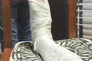 Mar de Ajó: denunció que fue golpeado tras ser confundido con un sospechoso del robo de motos