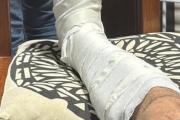 Mar de Ajó: denunció que fue golpeado tras ser confundido con un sospechoso del robo de motos