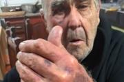 Brutal asalto a una pareja de 82 años: los golpearon e intentaron cortarle un dedo para robarle un anillo